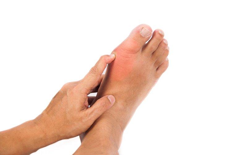 A Podiatrist Guide to Cosmetic Bunion Surgery